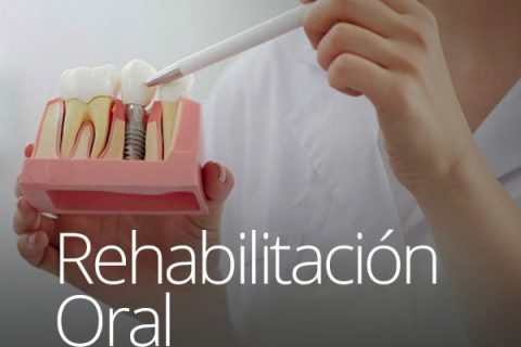 Rehabilitación Oral