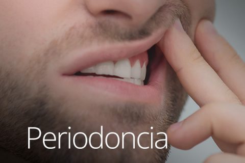 periodoncia web[8]